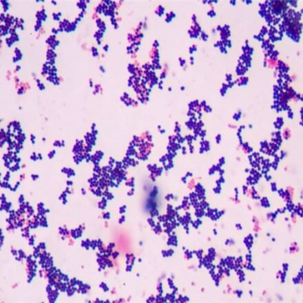 Грам для мікробіології набір барвників 100 тестів