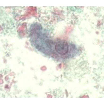 Гоморі трихром за Вітлі набір барвників 100 тестів