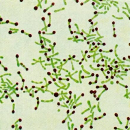 Альберт набір барвників 100 тестів