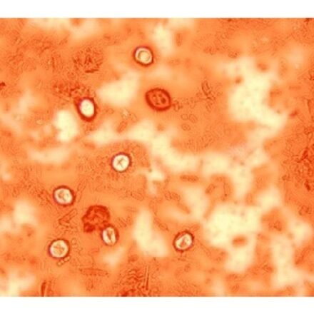 Мербромін набір барвників 100 тестів