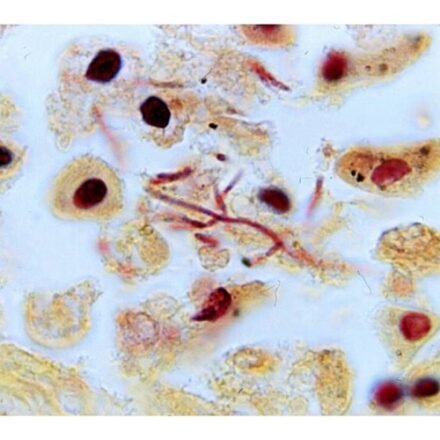 Браун та Бренн набір 100 тестів