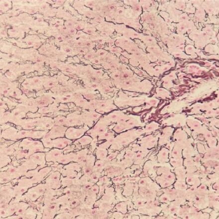 Гордон-Світ набір барвників 100 тестів