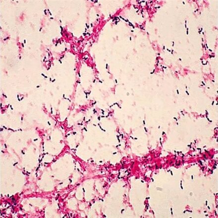 Грам для мікробіології (з основним фуксином) набір барвників 100 тестів