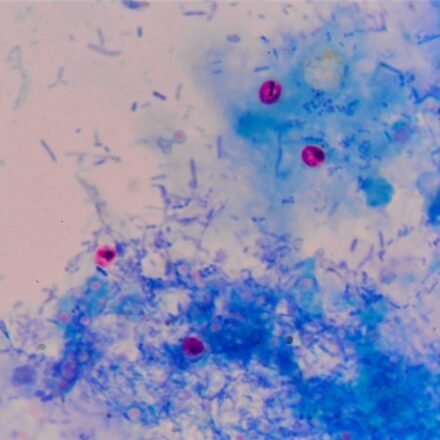 Циль Нільсен для криптоспоридій набір барвників 100 тестів