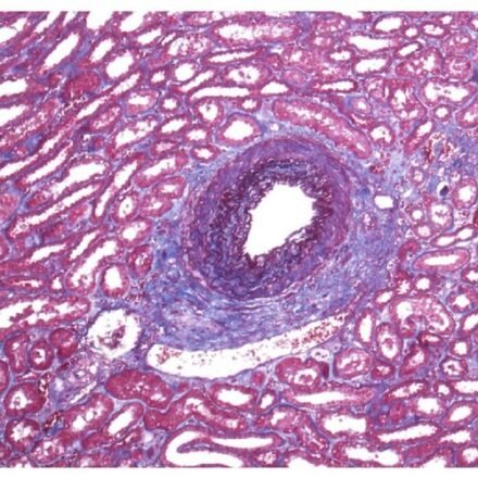 Вейгерт -Массон набір барвників 100 тестів